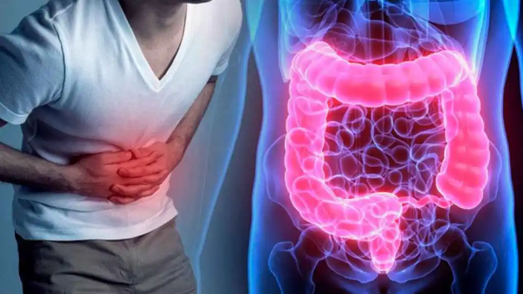 Como reducir la inflamación intestinal